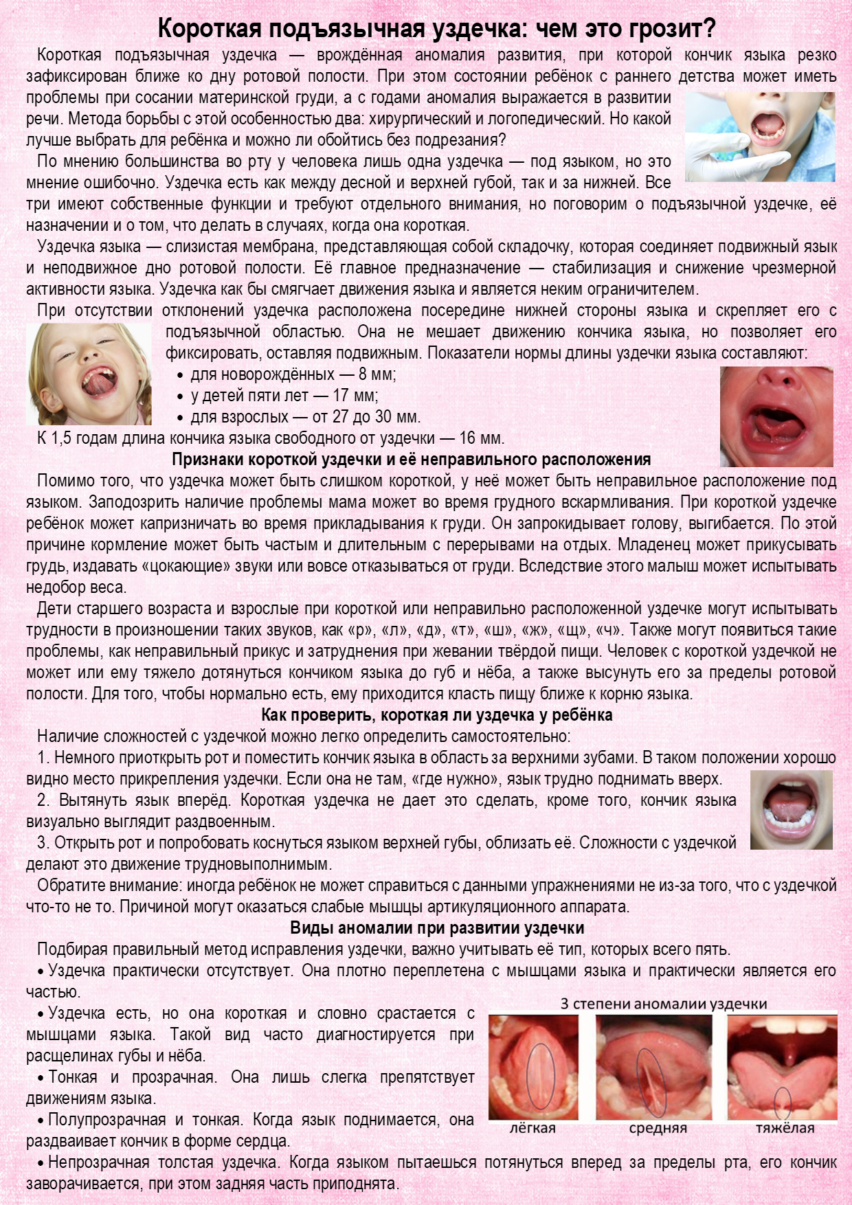 уздечка1.png